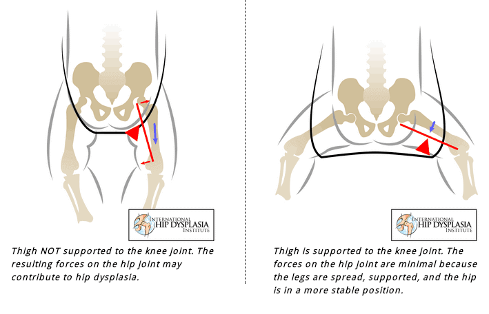 Healthy baby wearing techniques for hip stability