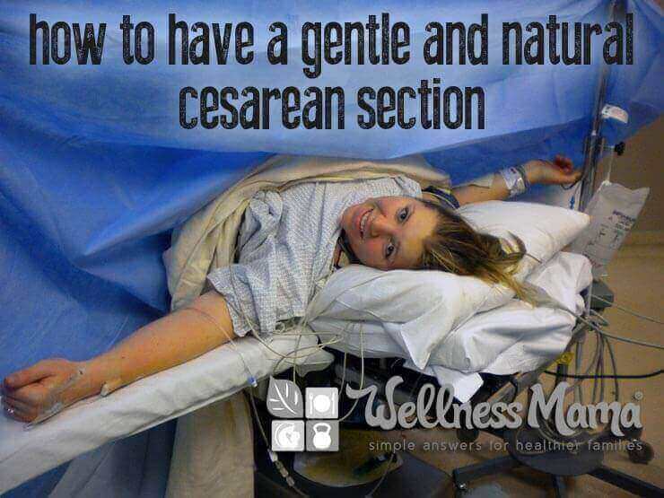 How to Have a Natural & Gentle Cesarean
