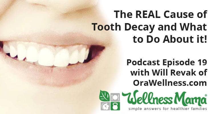 The Real Cause of Tooth Decay and What to Do About It
