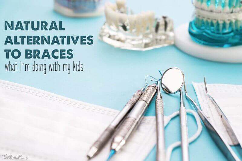 Alternatives to Braces (& What I’m Doing With My Kids)
