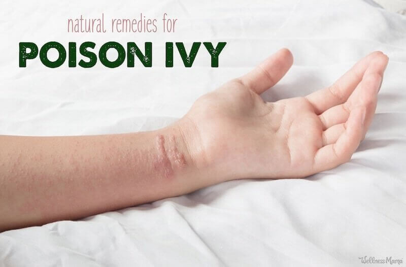 Itch-Stopping Natural Remedies for Poison Ivy