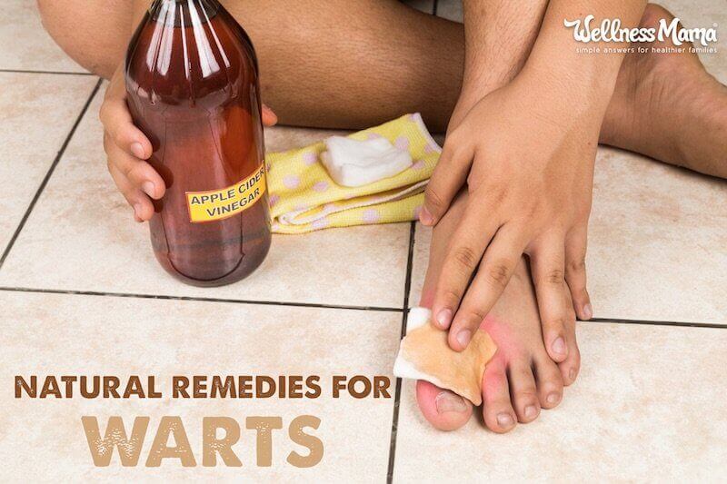 7 Effective Natural Remedies for Warts